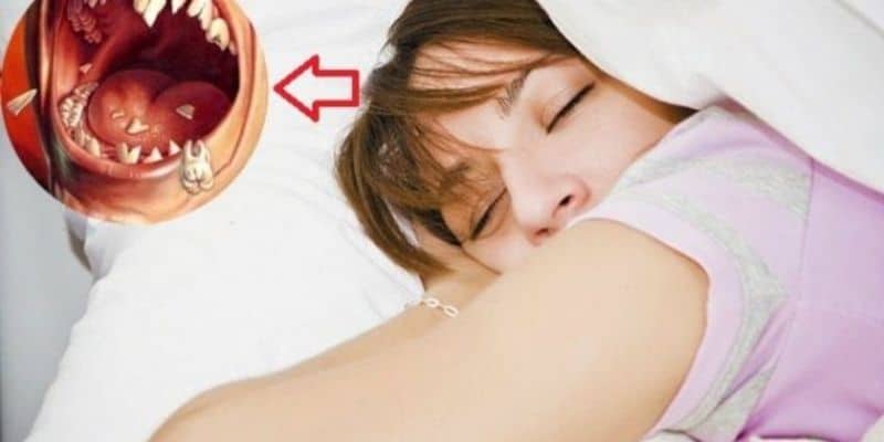 Nằm mơ rụng răng được xem như một điềm báo về sự mất mát